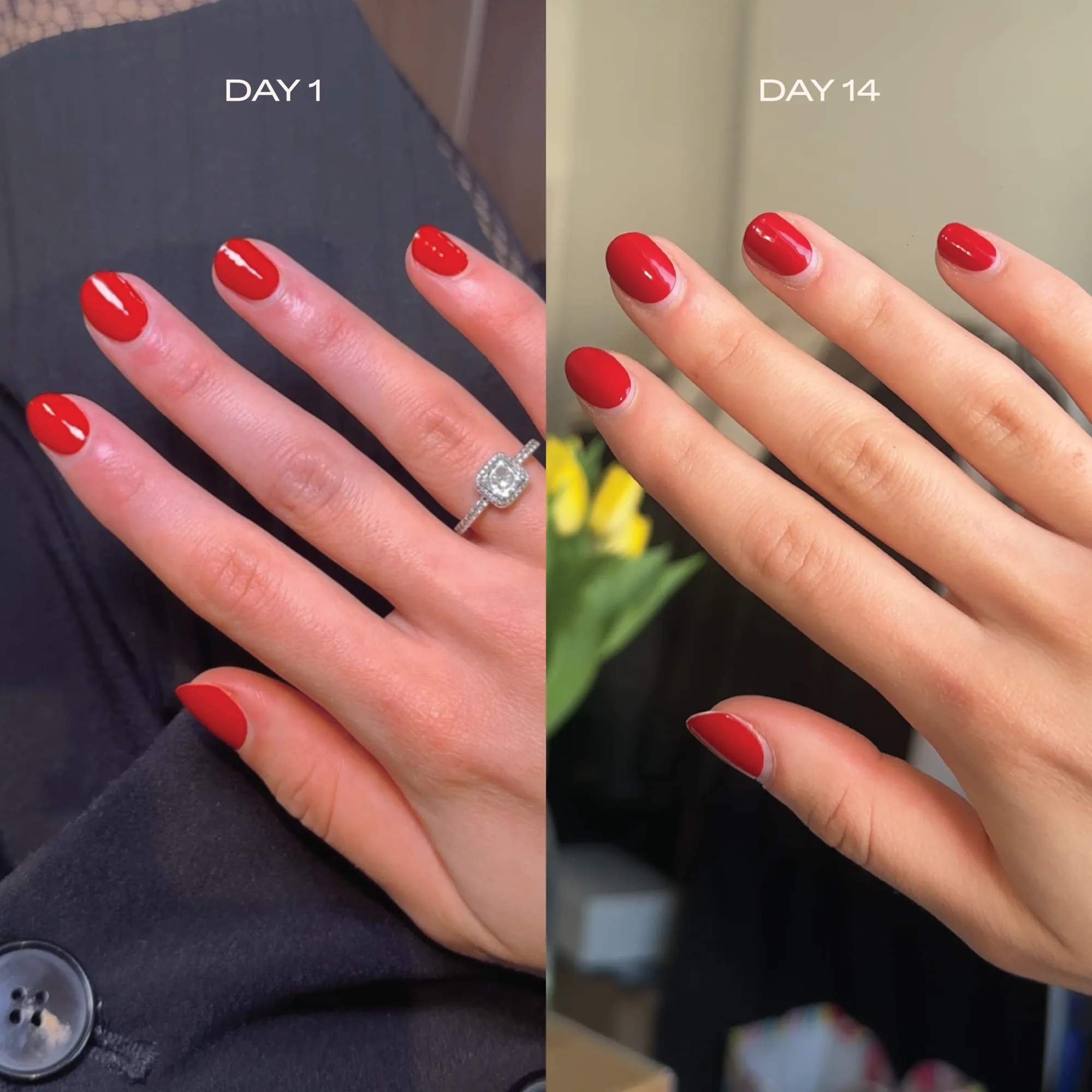 Day 1 vs. day 14 of wearing Glaize gels